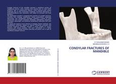 Copertina di CONDYLAR FRACTURES OF MANDIBLE