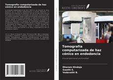 Copertina di Tomografía computarizada de haz cónico en endodoncia