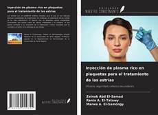 Buchcover von Inyección de plasma rico en plaquetas para el tratamiento de las estrías