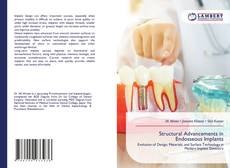 Bookcover of Structural Advancements in Endosseous Implants