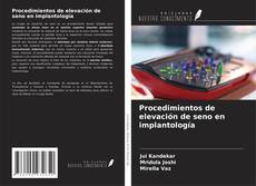 Buchcover von Procedimientos de elevación de seno en implantología