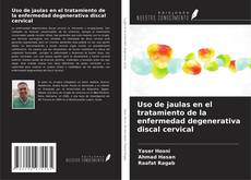 Buchcover von Uso de jaulas en el tratamiento de la enfermedad degenerativa discal cervical