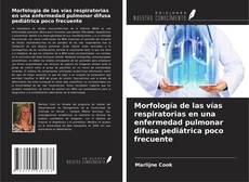 Buchcover von Morfología de las vías respiratorias en una enfermedad pulmonar difusa pediátrica poco frecuente