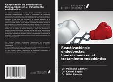 Buchcover von Reactivación de endodoncias: Innovaciones en el tratamiento endodóntico