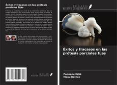 Buchcover von Éxitos y fracasos en las prótesis parciales fijas