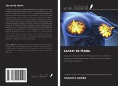 Buchcover von Cáncer de Mama