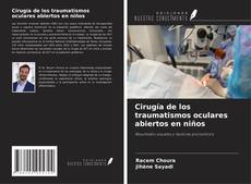 Buchcover von Cirugía de los traumatismos oculares abiertos en niños