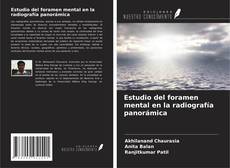 Couverture de Estudio del foramen mental en la radiografía panorámica
