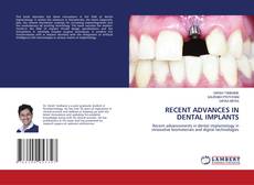 Borítókép a  RECENT ADVANCES IN DENTAL IMPLANTS - hoz