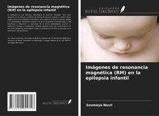 Buchcover von Imágenes de resonancia magnética (RM) en la epilepsia infantil