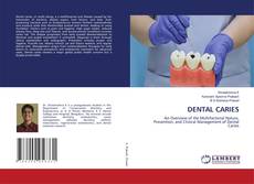 Portada del libro de DENTAL CARIES