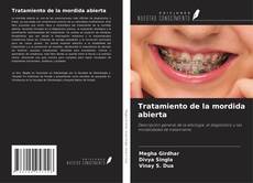 Copertina di Tratamiento de la mordida abierta