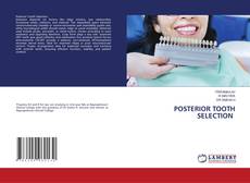 Bookcover of POSTERIOR TOOTH SELECTION
