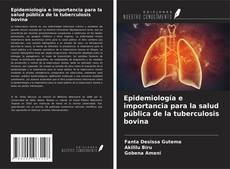 Buchcover von Epidemiología e importancia para la salud pública de la tuberculosis bovina