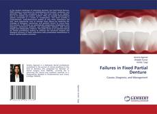 Bookcover of Failures in Fixed Partial Denture