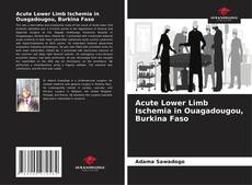 Bookcover of Acute Lower Limb Ischemia in Ouagadougou, Burkina Faso