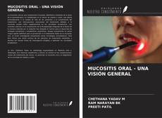 Copertina di MUCOSITIS ORAL - UNA VISIÓN GENERAL