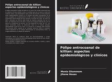 Copertina di Pólipo antrocoanal de killian: aspectos epidemiológicos y clínicos
