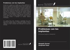 Buchcover von Problemas con los implantes