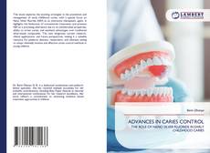 Bookcover of ADVANCES IN CARIES CONTROL