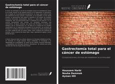 Buchcover von Gastrectomía total para el cáncer de estómago