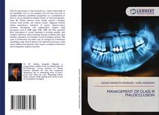 Portada del libro de MANAGEMENT OF CLASS III MALOCCLUSION