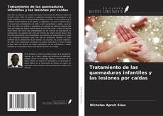Buchcover von Tratamiento de las quemaduras infantiles y las lesiones por caídas
