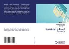 Bookcover of Biomaterials in Dental Implants