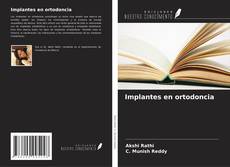Buchcover von Implantes en ortodoncia