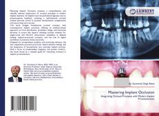 Bookcover of Mastering Implant Occlusion