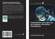 Buchcover von Tratamiento quirúrgico de las lesiones vasculares traumáticas
