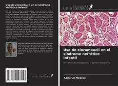 Copertina di Uso de clorambucil en el síndrome nefrótico infantil