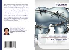 Bookcover of MOLAR UPRIGHTING