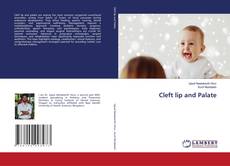 Bookcover of Cleft lip and Palate
