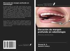 Borítókép a  Elevación de margen profundo en odontología - hoz