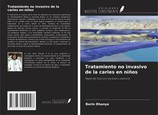 Buchcover von Tratamiento no invasivo de la caries en niños