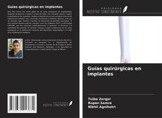 Copertina di Guías quirúrgicas en implantes