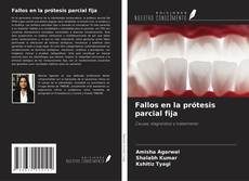 Copertina di Fallos en la prótesis parcial fija