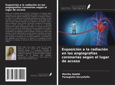 Capa do livro de Exposición a la radiación en las angiografías coronarias según el lugar de acceso 