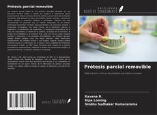 Buchcover von Prótesis parcial removible