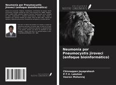 Couverture de Neumonía por Pneumocystis jiroveci (enfoque bioinformático)