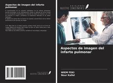 Buchcover von Aspectos de imagen del infarto pulmonar