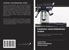 Copertina di Lesiones vesiculobulosas orales
