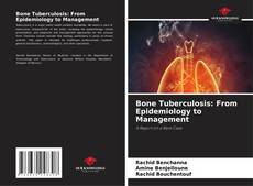 Borítókép a  Bone Tuberculosis: From Epidemiology to Management - hoz