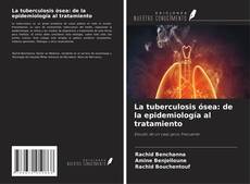 Copertina di La tuberculosis ósea: de la epidemiología al tratamiento