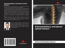 Borítókép a  Extramedullary intradural spinal tumors - hoz