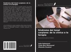 Síndrome del túnel carpiano: de la clínica a la terapia kitap kapağı