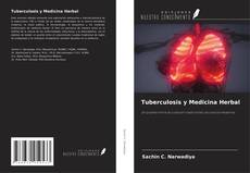 Copertina di Tuberculosis y Medicina Herbal