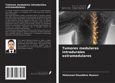 Copertina di Tumores medulares intradurales extramedulares