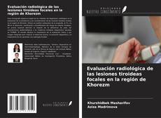 Copertina di Evaluación radiológica de las lesiones tiroideas focales en la región de Khorezm
